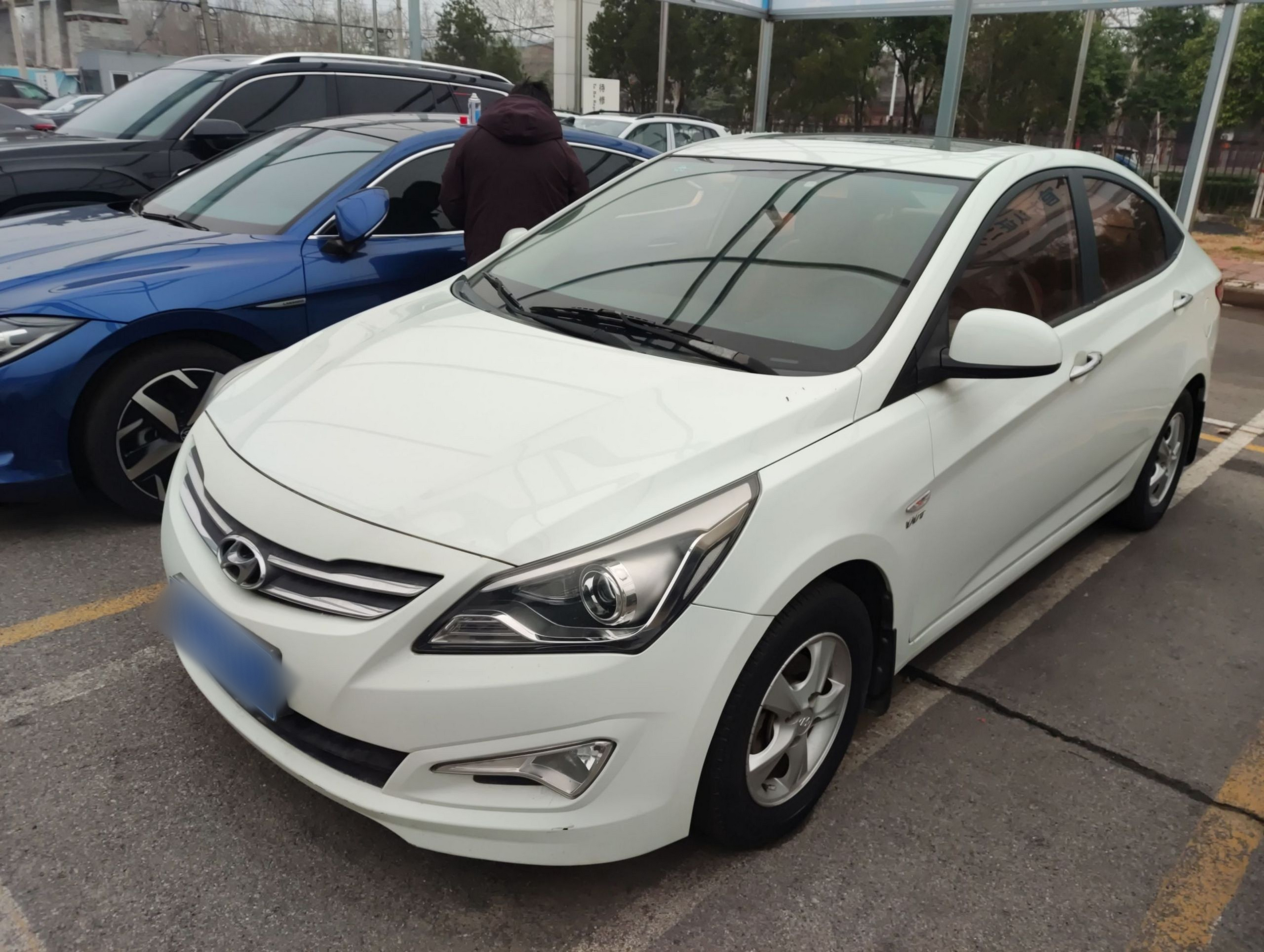 تحت مقدمة السيارة