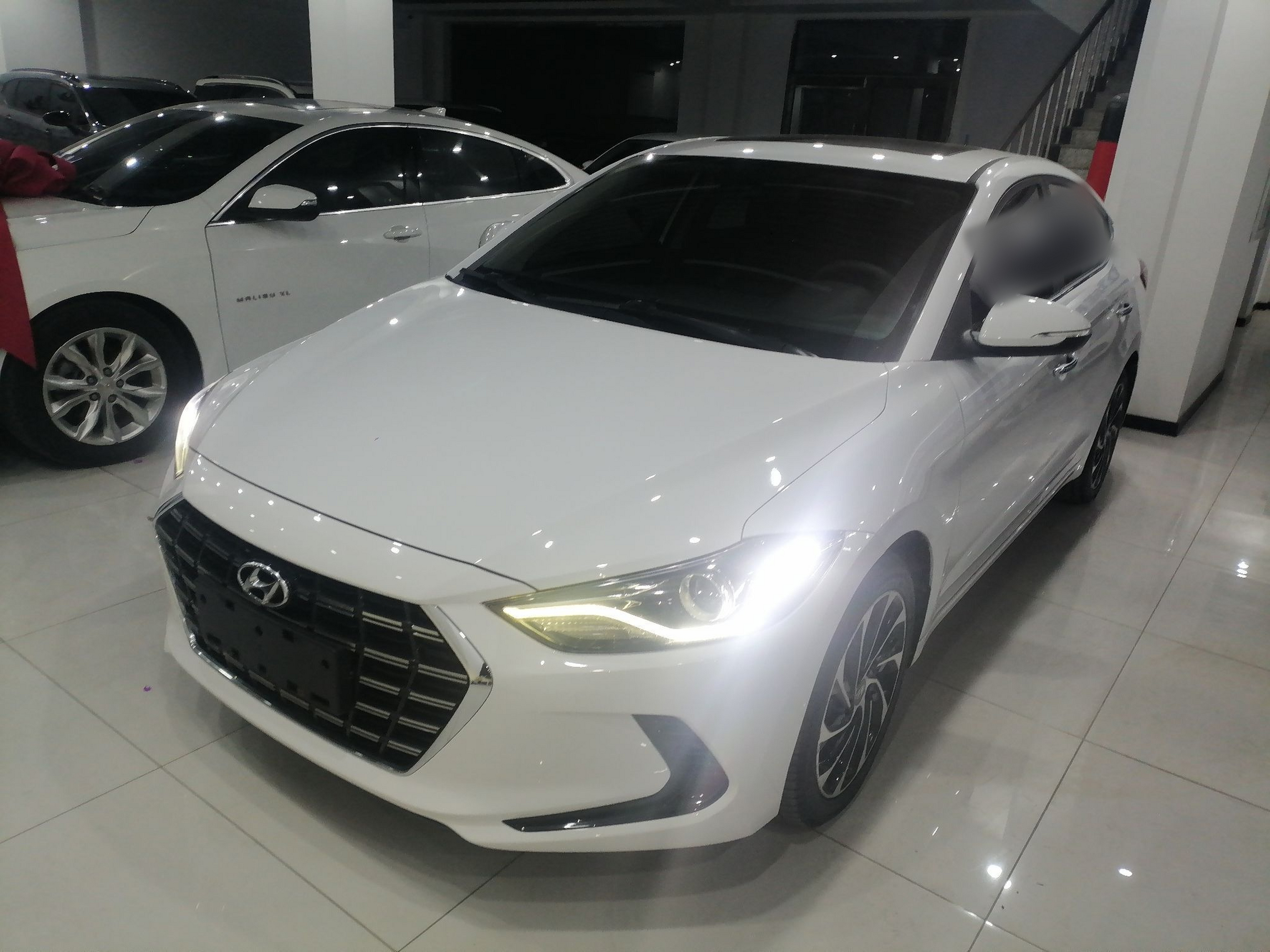 تحت مقدمة السيارة