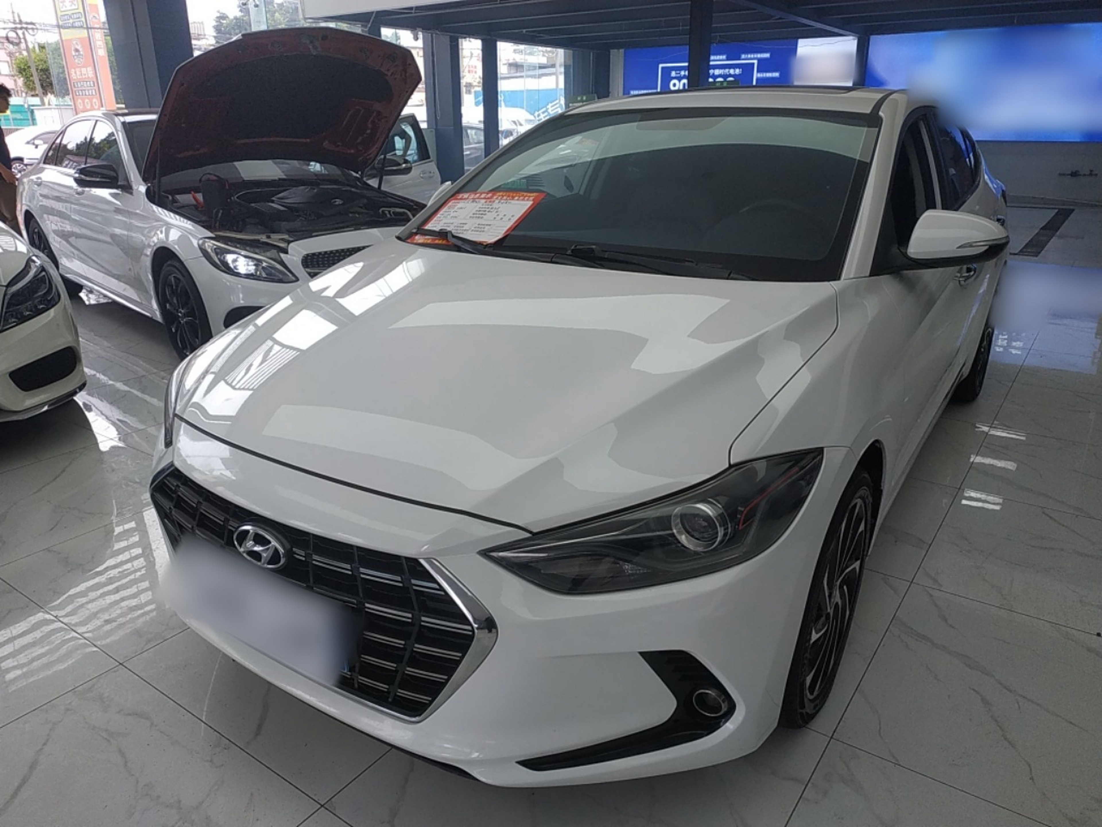 تحت مقدمة السيارة