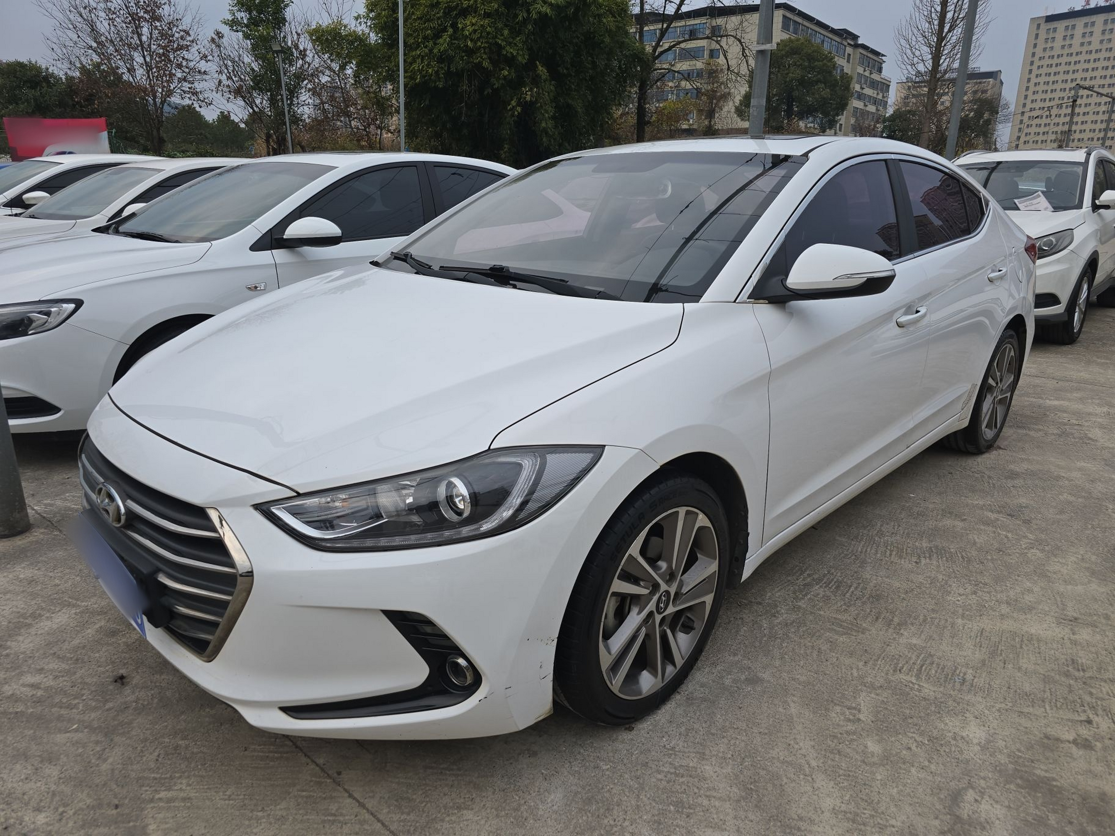 تحت مقدمة السيارة