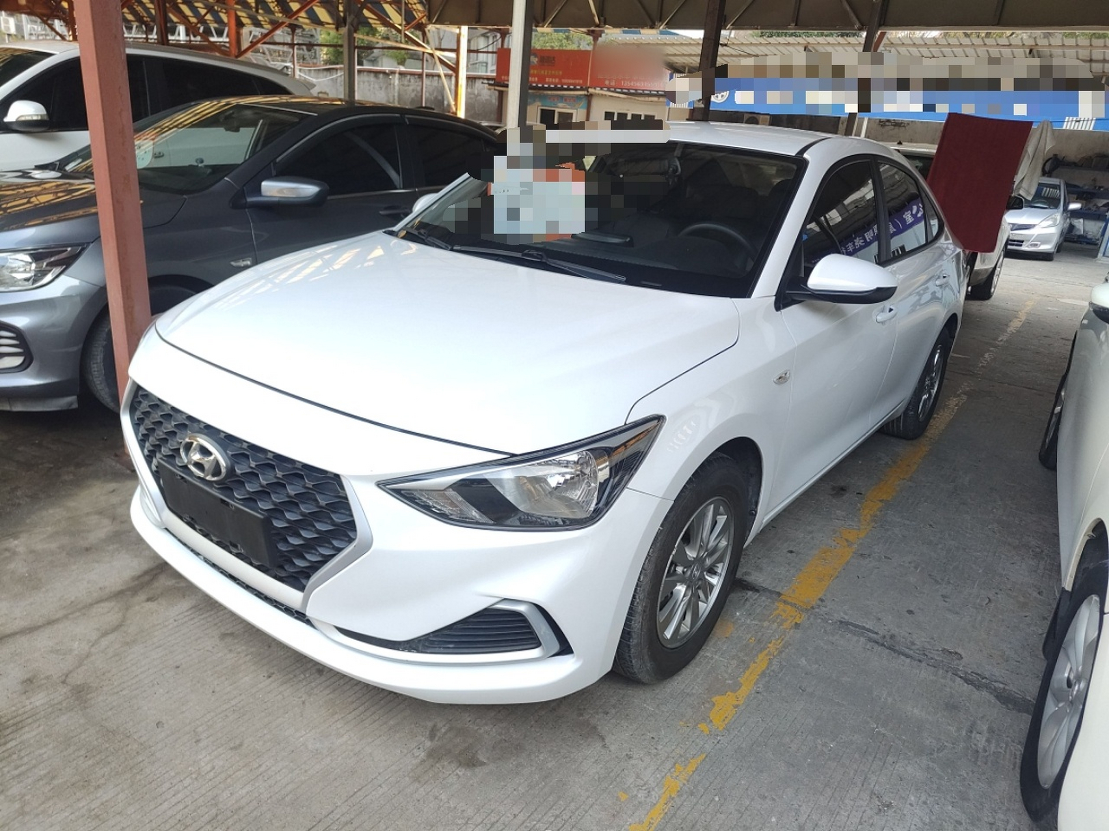 تحت مقدمة السيارة