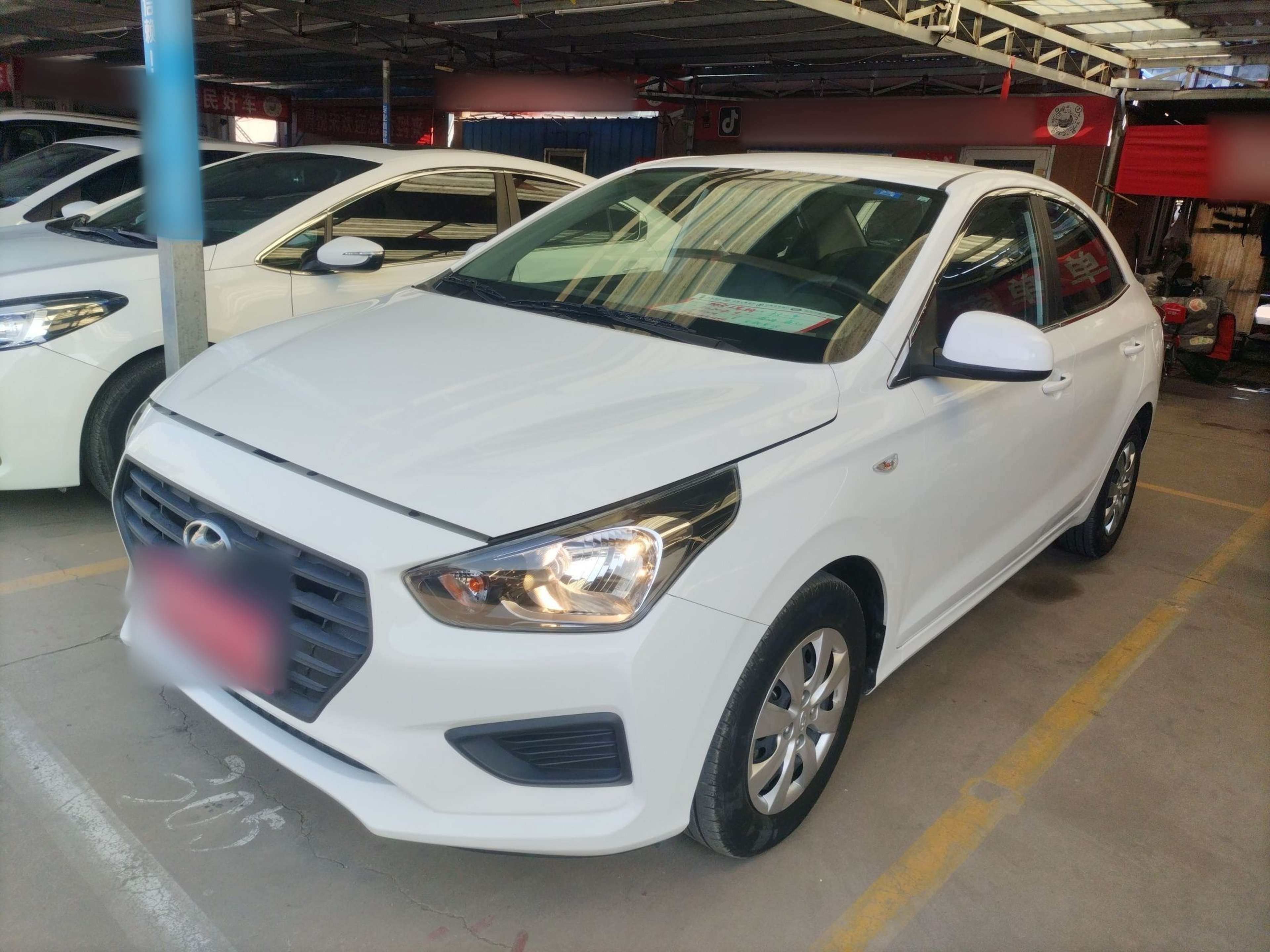 تحت مقدمة السيارة