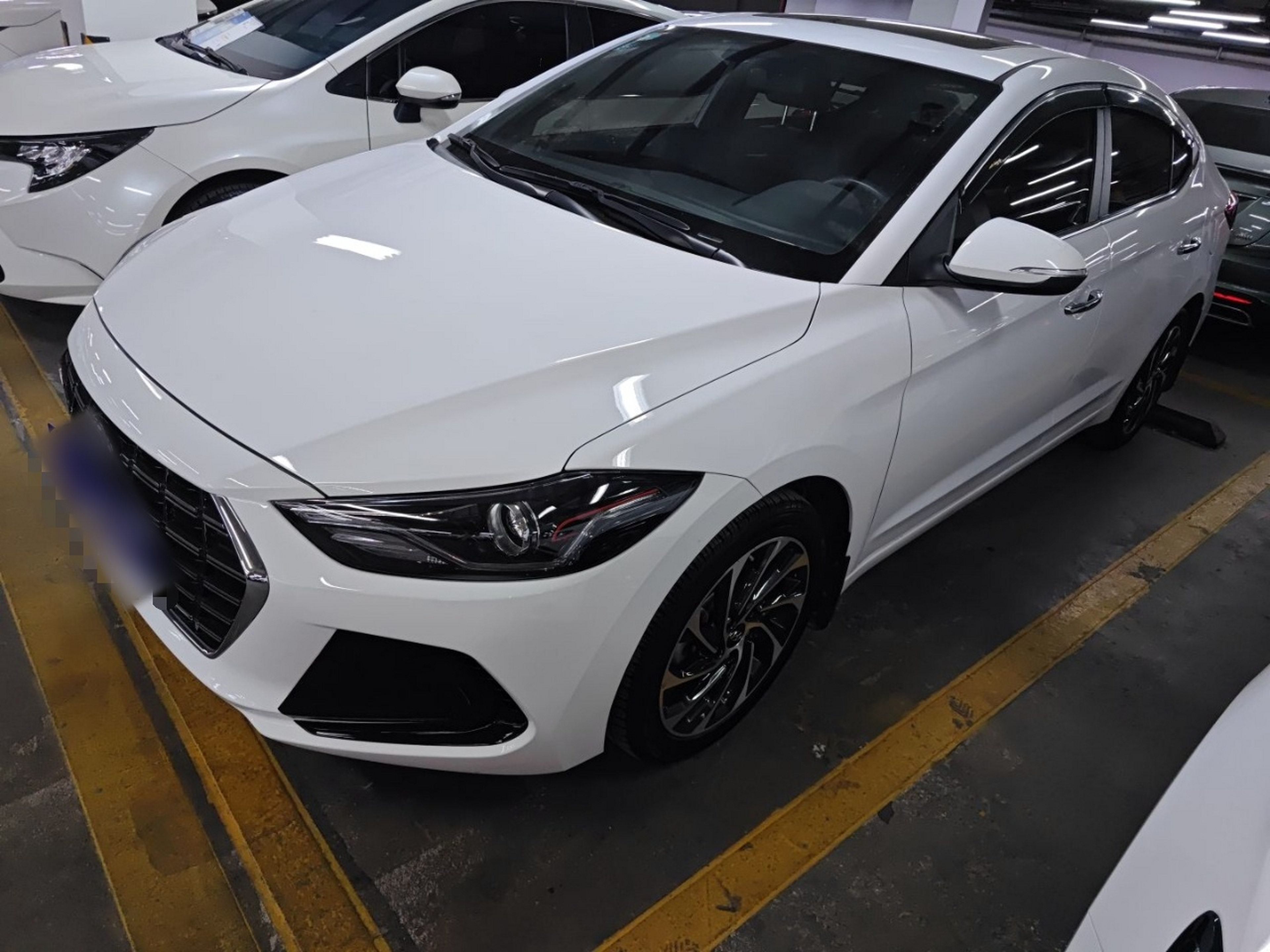 تحت مقدمة السيارة