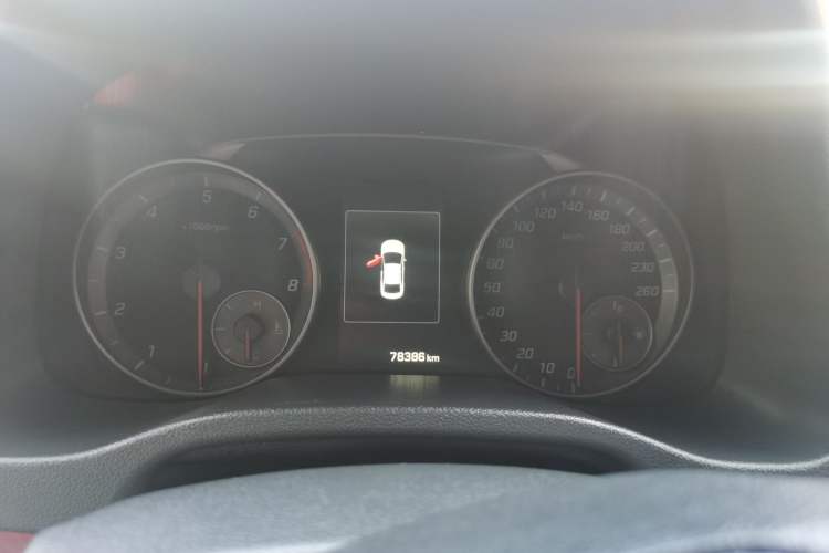 Used Hyundai Elantra 2018 1.4T Dual-Clutch Xuan Dong · Dynamic Edition